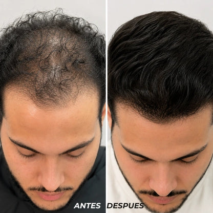 Shampoo Anticaida y Crecimiento - Ancestral Premium x 500ml
