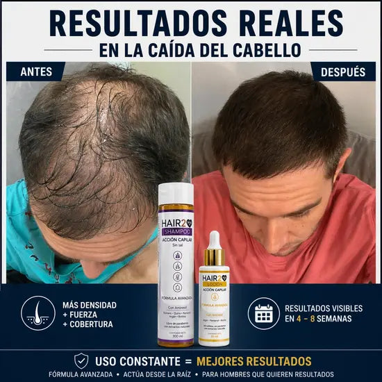 Duo Anticaida Capilar Shampoo + Tonico