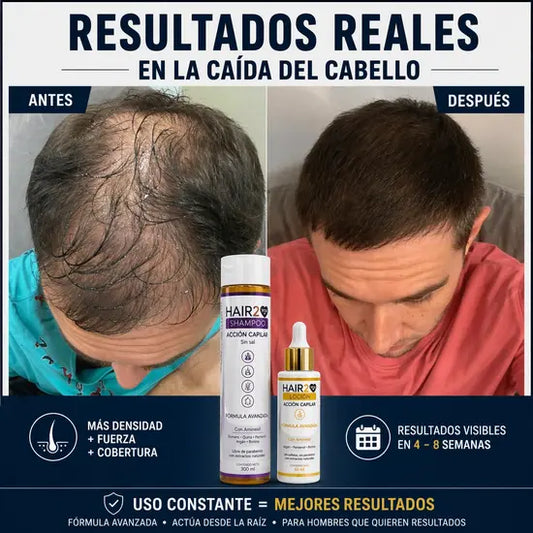 Duo Anticaida Capilar Shampoo + Tonico