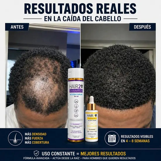 Duo Anticaida Capilar Shampoo + Tonico