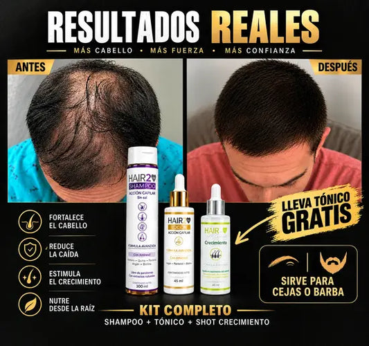 Duo Anticaida Capilar Shampoo + Tonico + Tonico Gratis