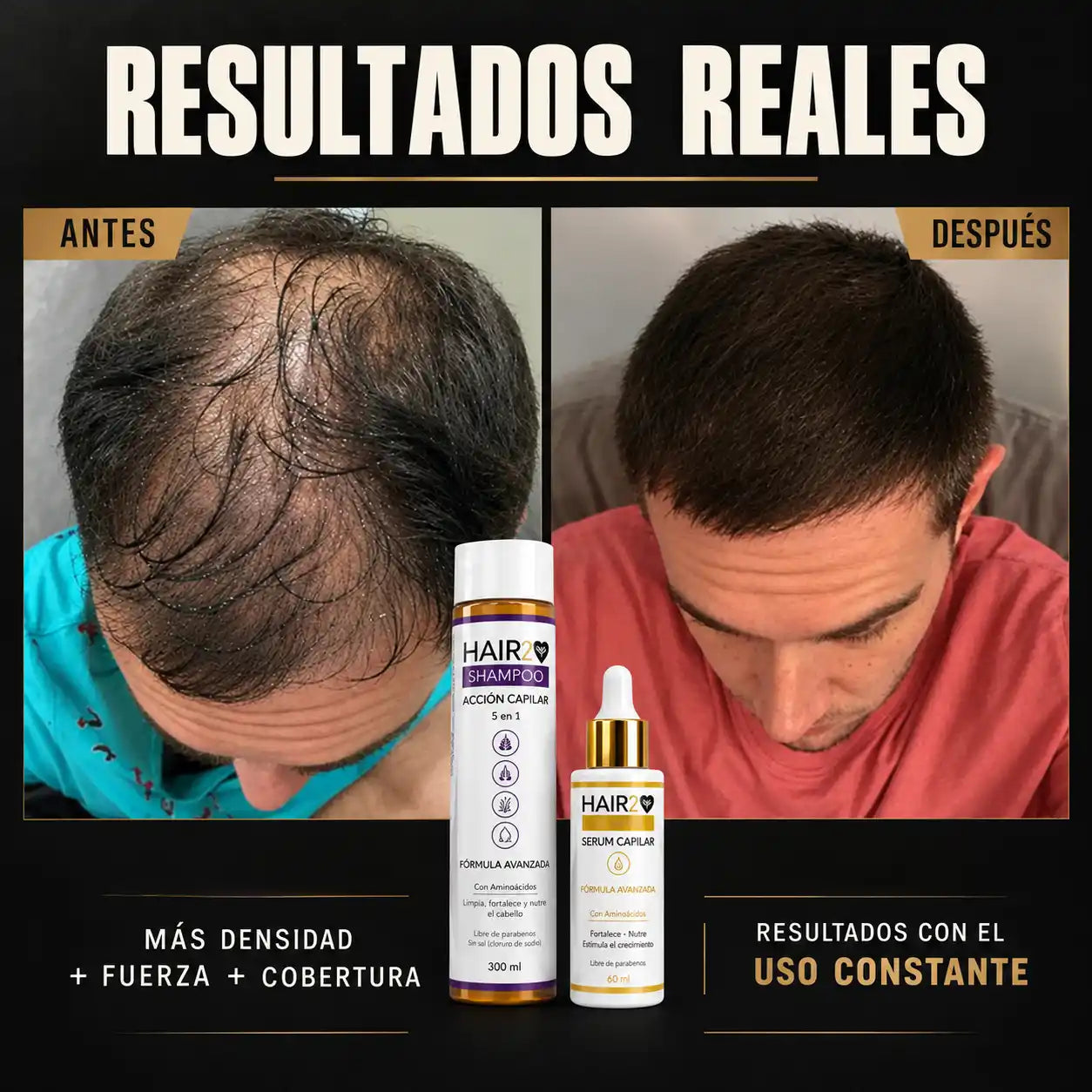 Duo Anticaida y Crecimiento Capilar Shampoo + Tonico