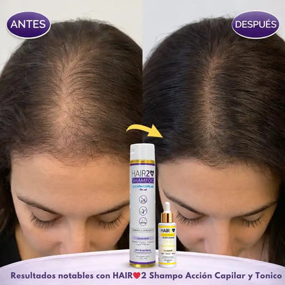 Duo Anticaida Capilar Shampoo + Tonico
